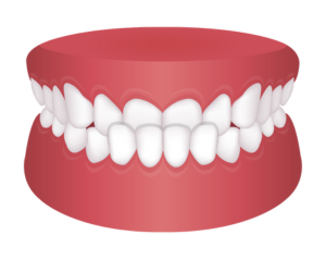 受け口 {{brizy_dc_image_alt imageSrc=