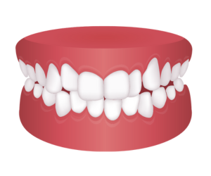 叢生 {{brizy_dc_image_alt imageSrc=